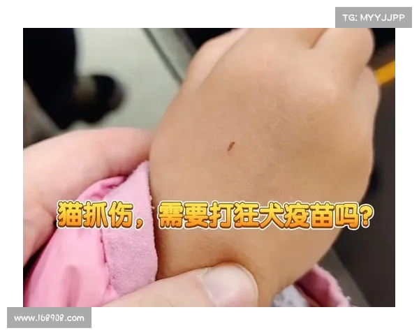 猫咬伤传染病的治疗方法大揭秘 猫咬伤传染病的治疗方法大揭秘